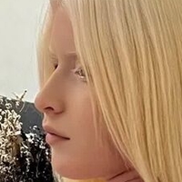 Albino Models Nude