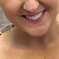 Alicemilks Nude