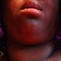darkcocochunk Nude