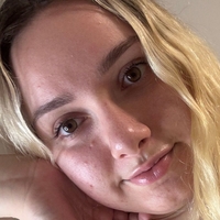 edensmelons2 Nude