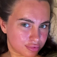 Elmdxo Nude