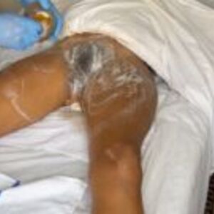Female Accidental Arousal Nude