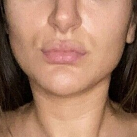 mianolan Nude