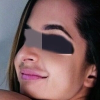 Rainha Do Anal Nude