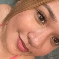 Skittlespotting Nude