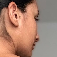 tinilat Nude