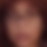toxicabellaca Nude